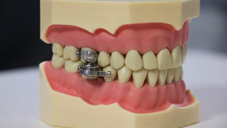 These Scientists Created a Controversial ‘Weight-Loss Device’ that Locks People’s Jaws Shut