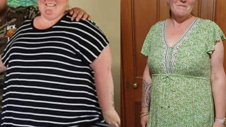 Weight loss journey: Kiwi mum of five turns down gastric sleeve surgery, drops 62kg - NZ Herald