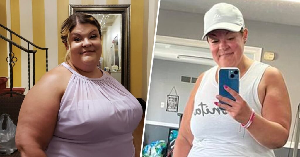 Weight Loss of 105 Pounds Helps Woman Find Breast Cancer